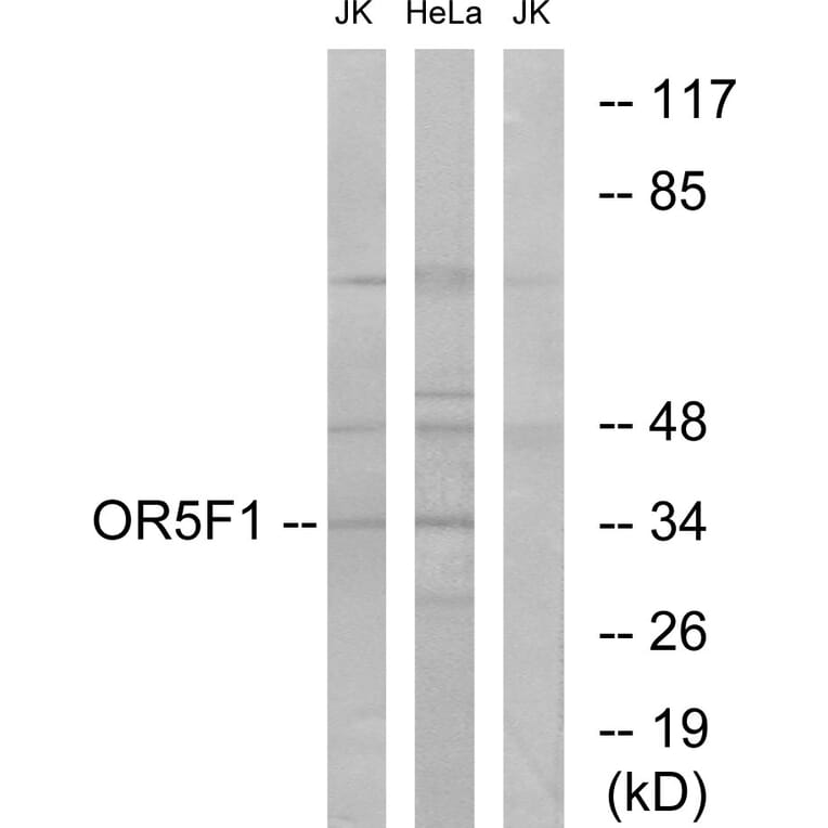 Western Blot - Anti-OR5F1 Antibody (G637) - Antibodies.com