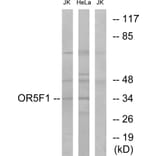 Western Blot - Anti-OR5F1 Antibody (G637) - Antibodies.com