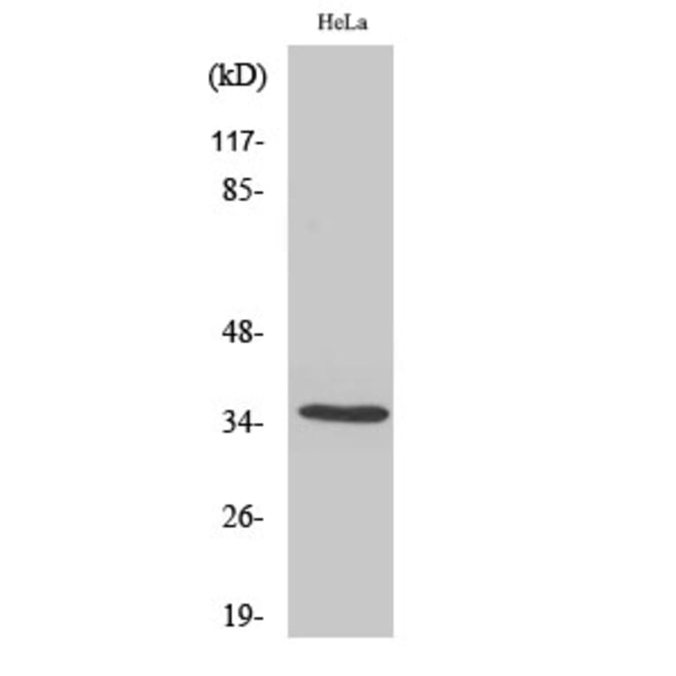Western Blot - Anti-OR5F1 Antibody (G637) - Antibodies.com