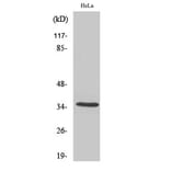 Western Blot - Anti-OR5F1 Antibody (G637) - Antibodies.com
