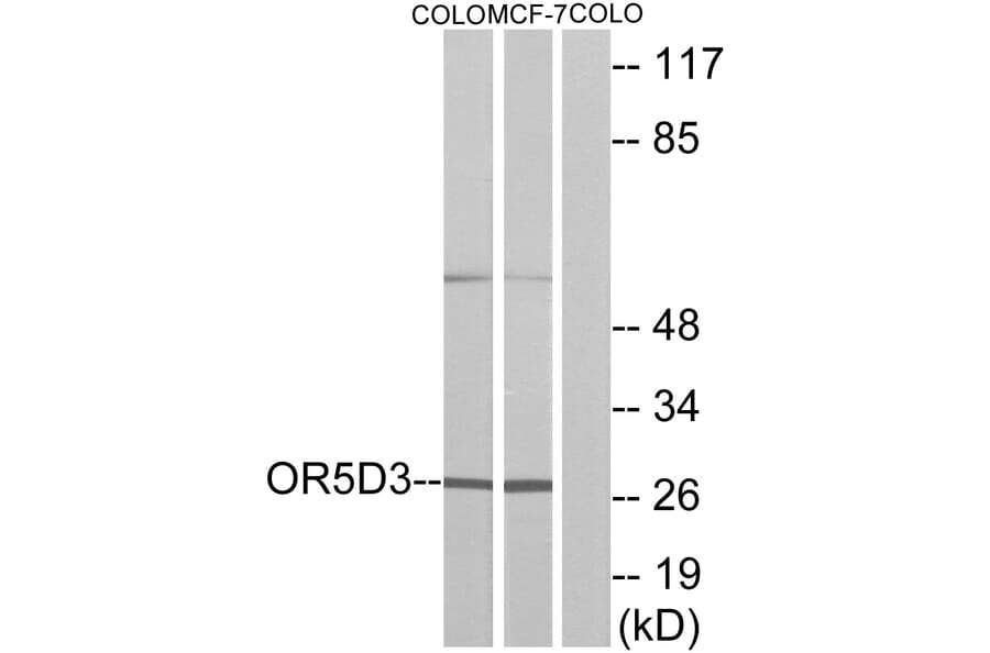 Western Blot - Anti-OR5D3 Antibody (G636) - Antibodies.com
