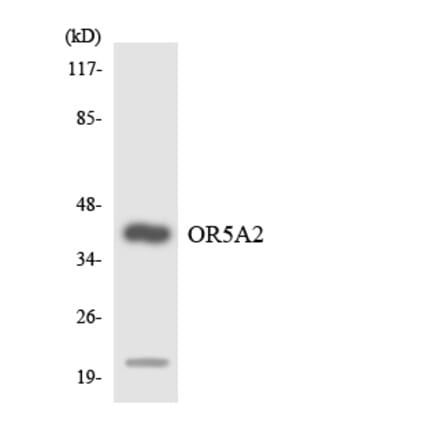 Western Blot - Anti-OR5A2 Antibody (R12-3226) - Antibodies.com