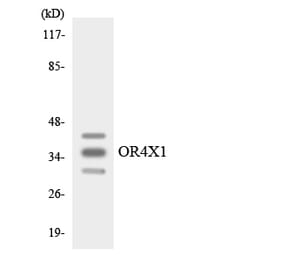 Western Blot - Anti-OR4X1 Antibody (R12-3198) - Antibodies.com