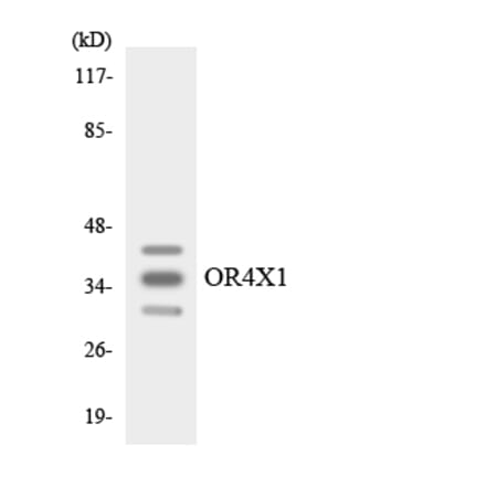 Western Blot - Anti-OR4X1 Antibody (R12-3198) - Antibodies.com
