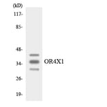 Western Blot - Anti-OR4X1 Antibody (R12-3198) - Antibodies.com