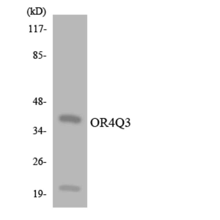 Western Blot - Anti-OR4Q3 Antibody (R12-3197) - Antibodies.com