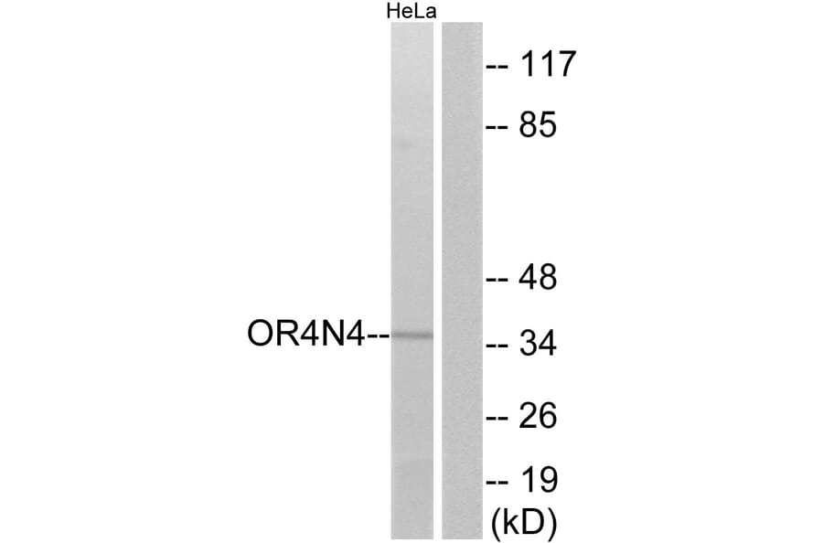 Western Blot - Anti-OR4N4 Antibody (G610) - Antibodies.com