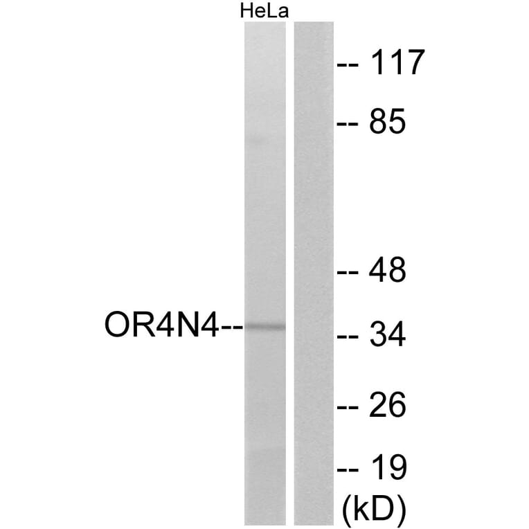Western Blot - Anti-OR4N4 Antibody (G610) - Antibodies.com