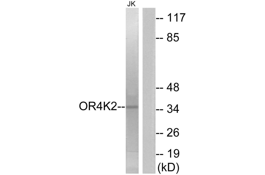 Western Blot - Anti-OR4K2 Antibody (G602) - Antibodies.com