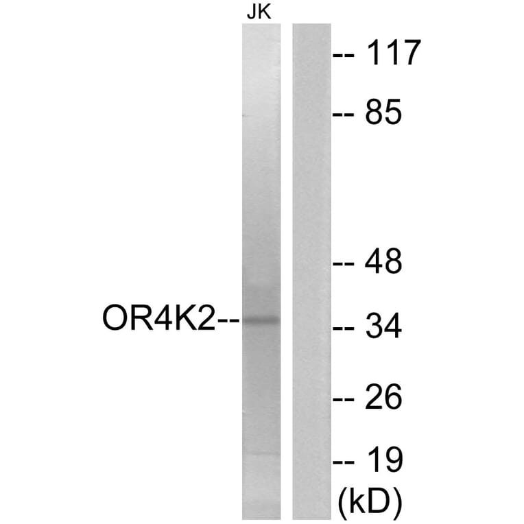 Western Blot - Anti-OR4K2 Antibody (G602) - Antibodies.com