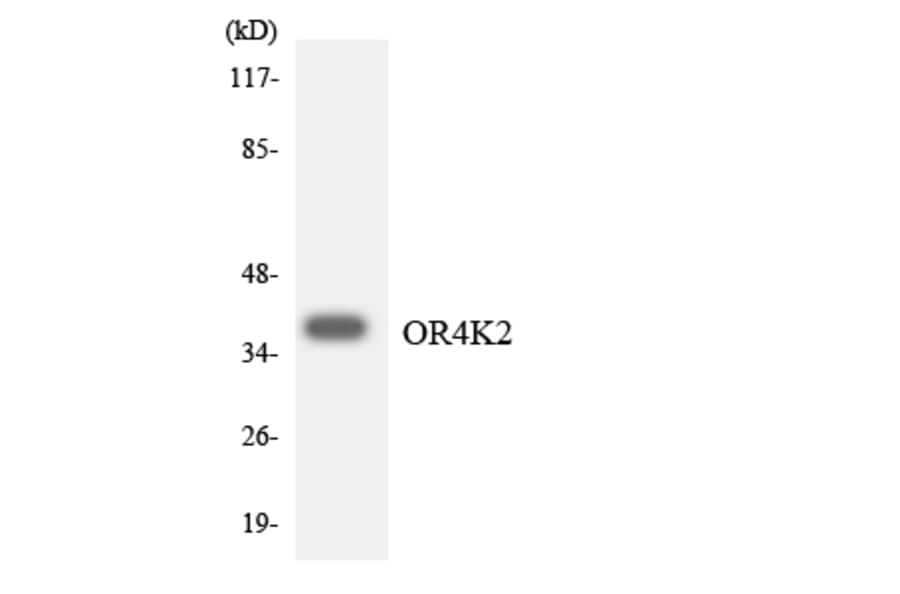 Western Blot - Anti-OR4K2 Antibody (R12-3193) - Antibodies.com
