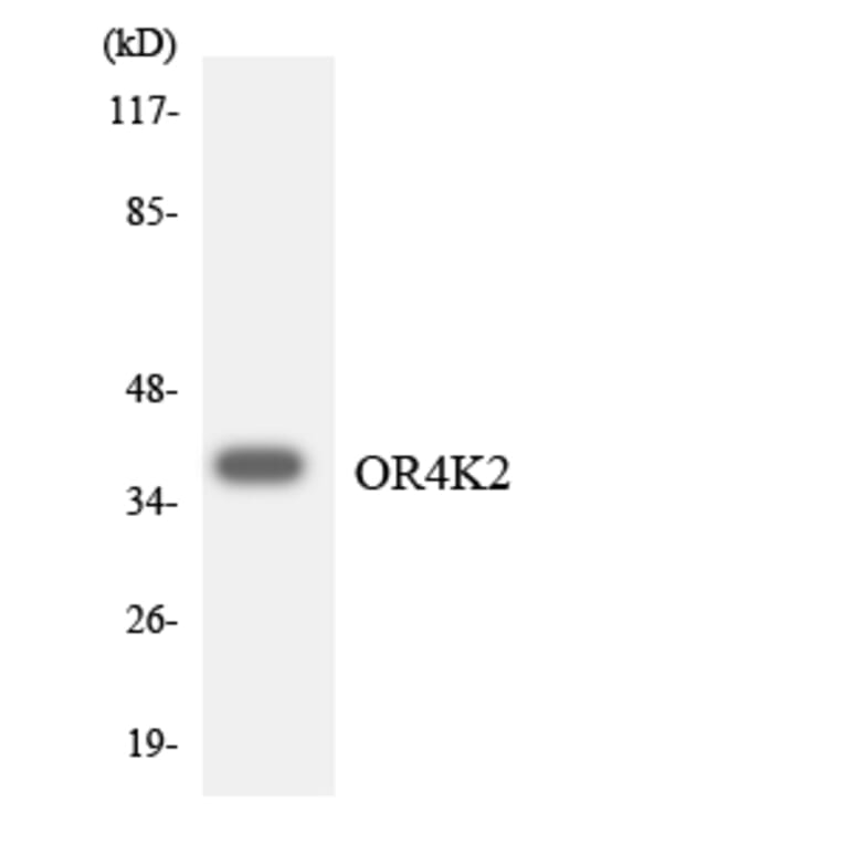 Western Blot - Anti-OR4K2 Antibody (R12-3193) - Antibodies.com