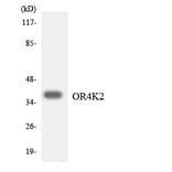 Western Blot - Anti-OR4K2 Antibody (R12-3193) - Antibodies.com