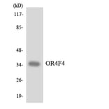 Western Blot - Anti-OR4F4 Antibody (R12-3190) - Antibodies.com