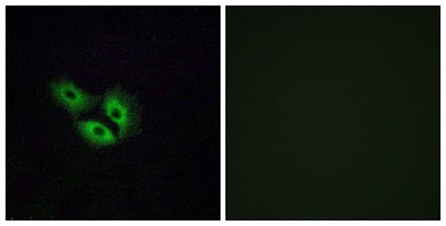 Immunofluorescence analysis of A549 cells using Anti-OR4E2 Antibody. The right hand panel represents a negative control, where the antibody was pre-incubated with the immunising peptide.