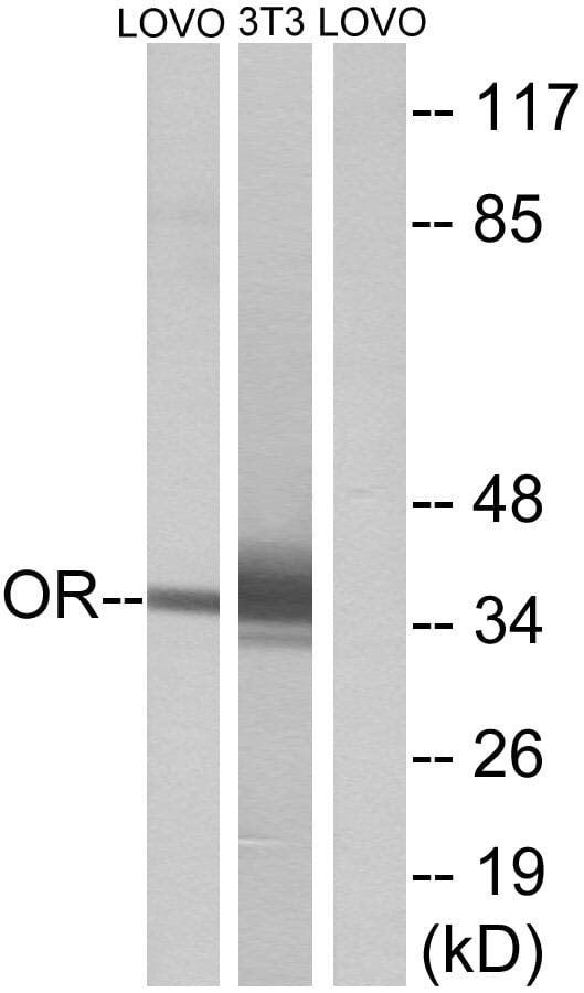 Western blot analysis of lysates from LOVO and NIH/3T3 cells using Anti-OR4D6 Antibody. The right hand lane represents a negative control, where the antibody is blocked by the immunising peptide.