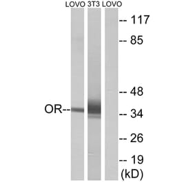 Western Blot - Anti-OR4D6 Antibody (G594) - Antibodies.com