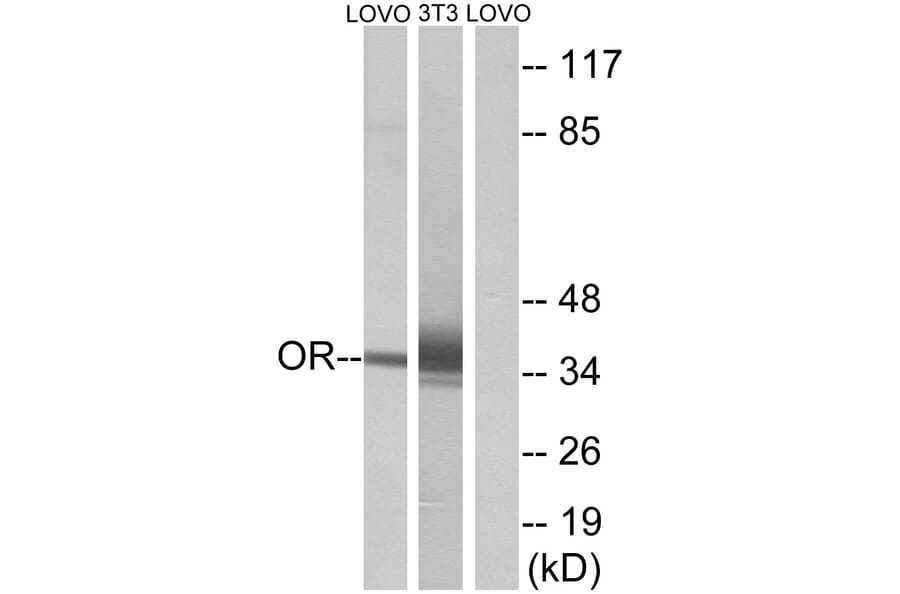 Western Blot - Anti-OR4D6 Antibody (G594) - Antibodies.com