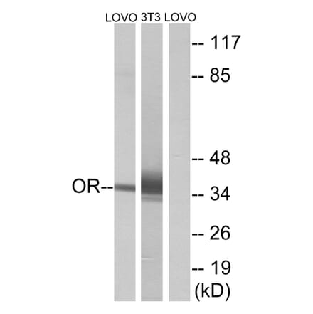 Western Blot - Anti-OR4D6 Antibody (G594) - Antibodies.com