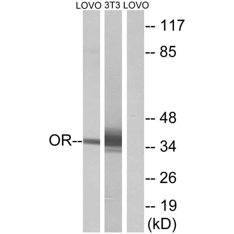Western Blot - Anti-OR4D6 Antibody (G594) - Antibodies.com