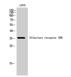 Western blot analysis of LOVO cells using Anti-OR4D6 Antibody.