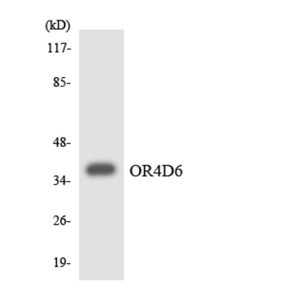 Western Blot - Anti-OR4D6 Antibody (R12-3189) - Antibodies.com