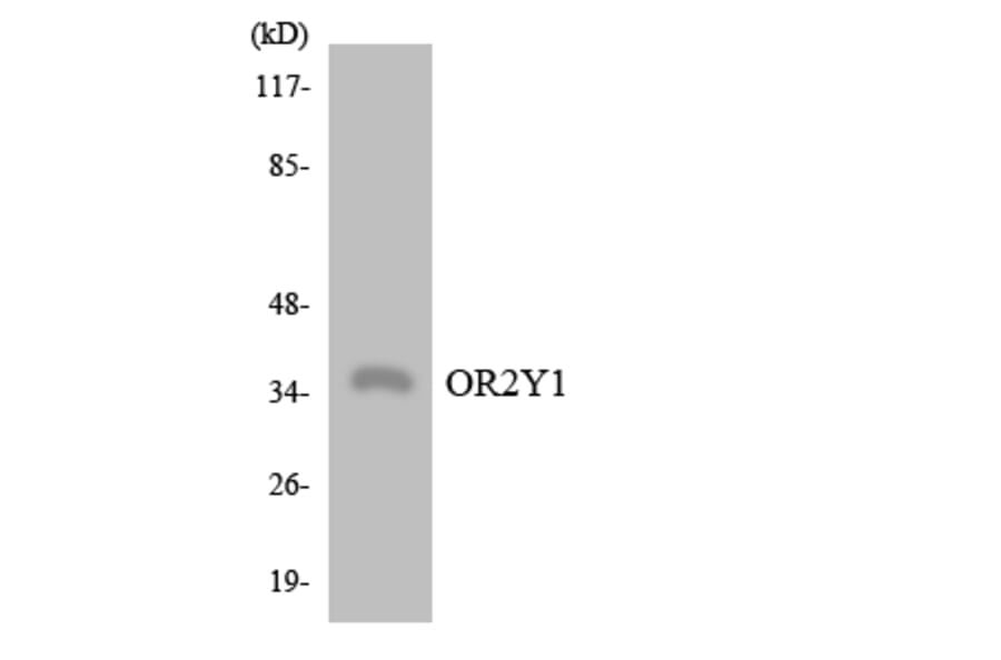 Western Blot - Anti-OR2Y1 Antibody (R12-3176) - Antibodies.com