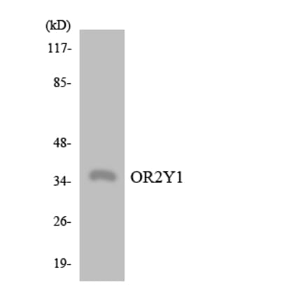 Western Blot - Anti-OR2Y1 Antibody (R12-3176) - Antibodies.com