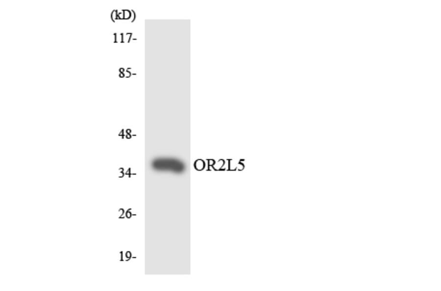 Western Blot - Anti-OR2L5 Antibody (R12-3169) - Antibodies.com