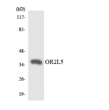 Western Blot - Anti-OR2L5 Antibody (R12-3169) - Antibodies.com