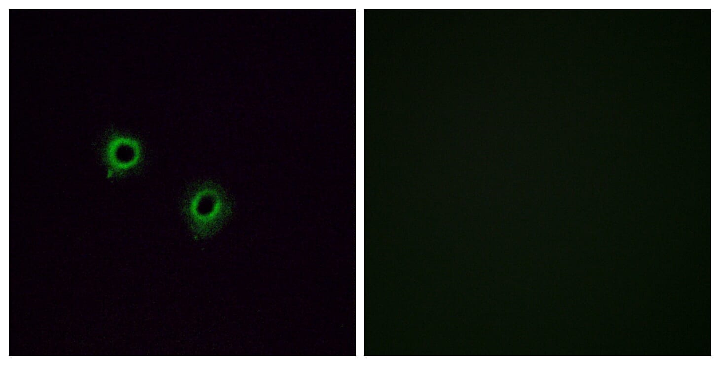 Immunofluorescence analysis of A549 cells using Anti-OR2J3 Antibody. The right hand panel represents a negative control, where the antibody was pre-incubated with the immunising peptide.