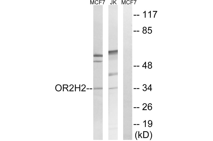 Western Blot - Anti-OR2H2 Antibody (G551) - Antibodies.com