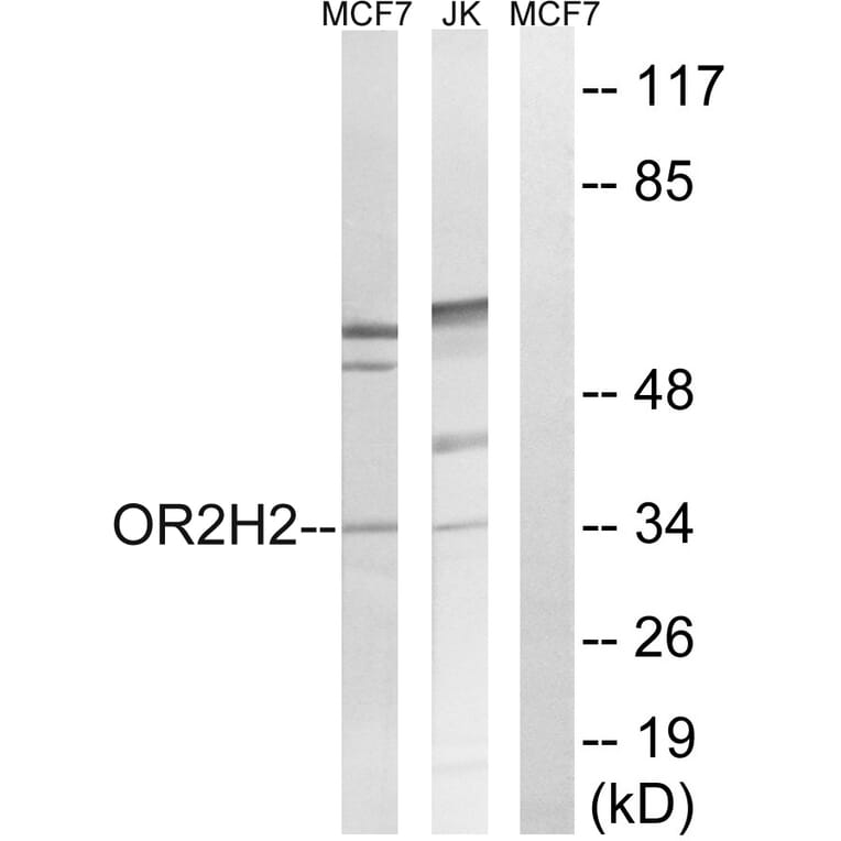 Western Blot - Anti-OR2H2 Antibody (G551) - Antibodies.com
