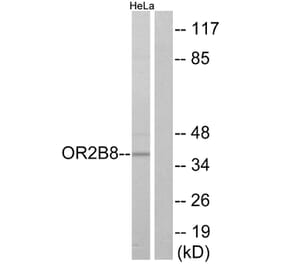 Western Blot - Anti-OR2B8 Antibody (G542) - Antibodies.com