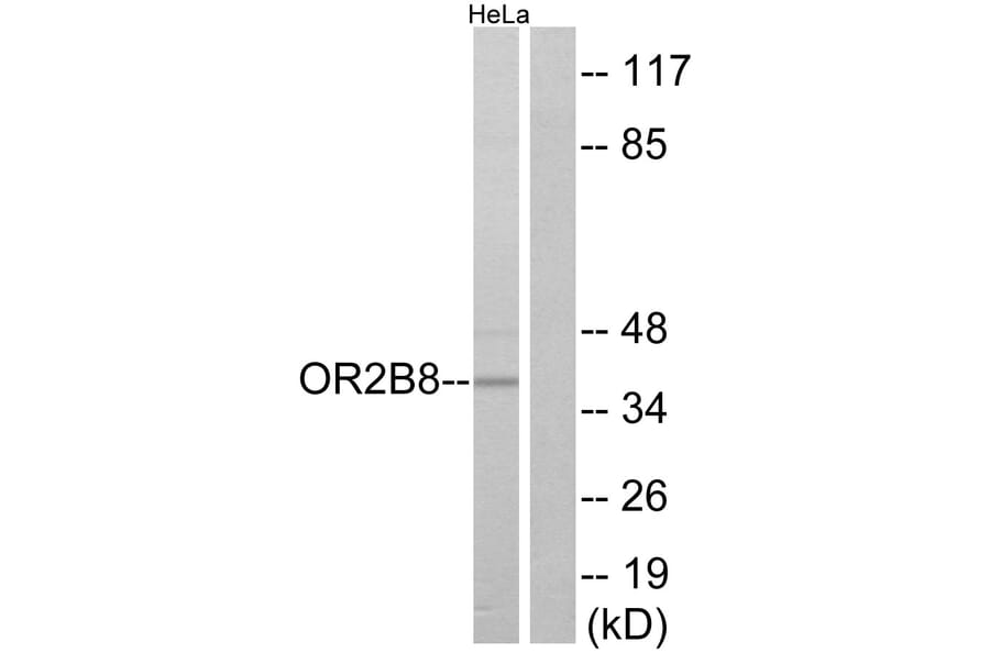 Western Blot - Anti-OR2B8 Antibody (G542) - Antibodies.com