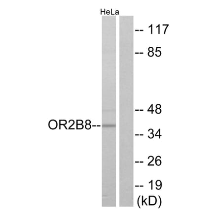 Western Blot - Anti-OR2B8 Antibody (G542) - Antibodies.com
