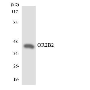 Western blot analysis of the lysates from Jurkat cells using Anti-OR2B2 Antibody.