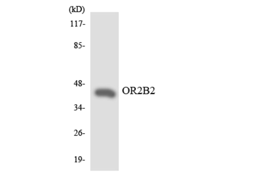 Western Blot - Anti-OR2B2 Antibody (R12-3163) - Antibodies.com