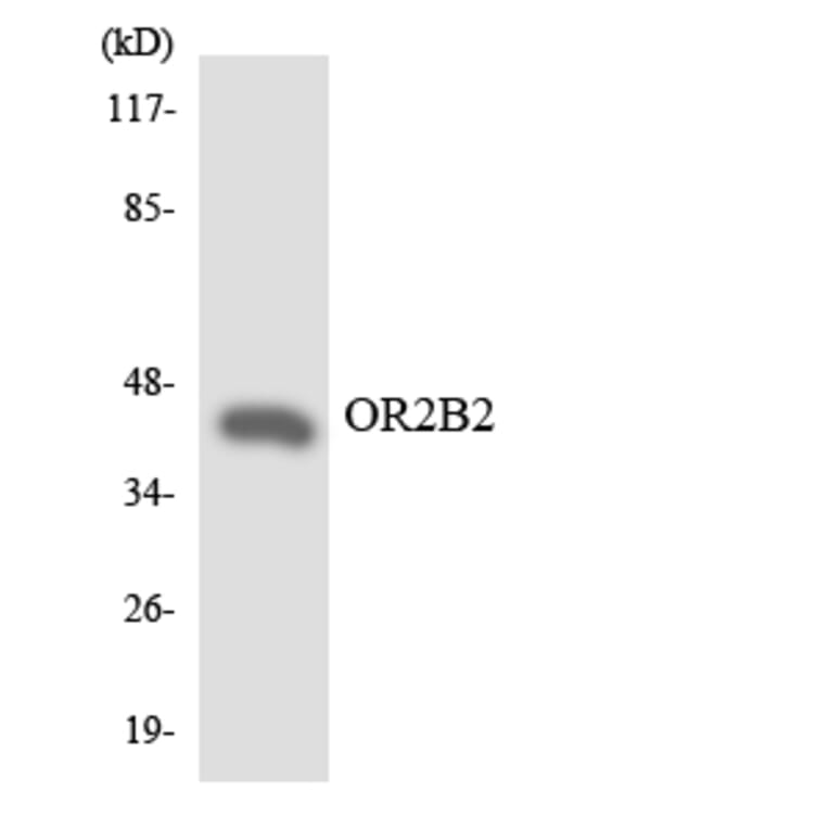 Western Blot - Anti-OR2B2 Antibody (R12-3163) - Antibodies.com