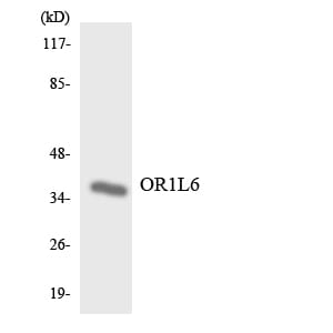 Western blot analysis of the lysates from COLO205 cells using Anti-OR1L6 Antibody.