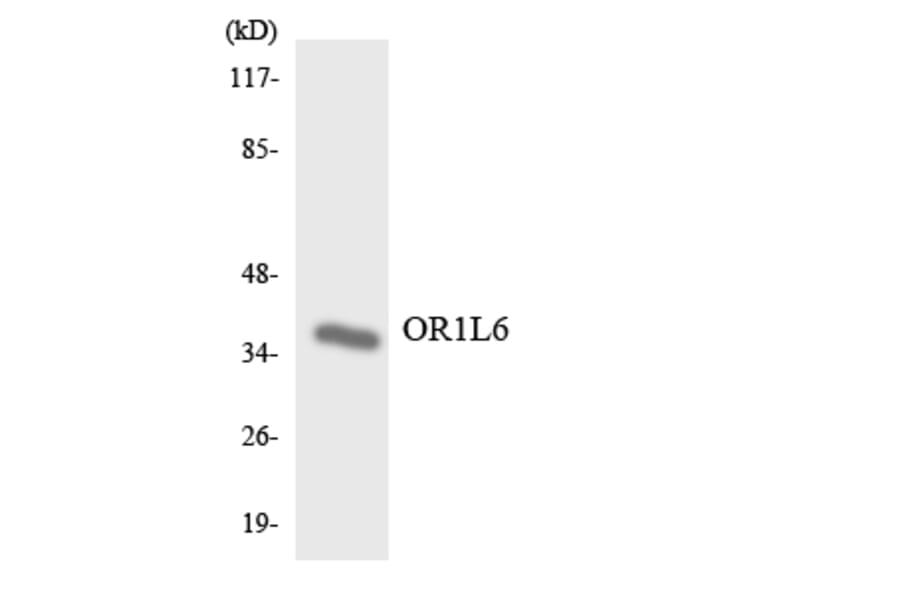Western Blot - Anti-OR1L6 Antibody (R12-3154) - Antibodies.com