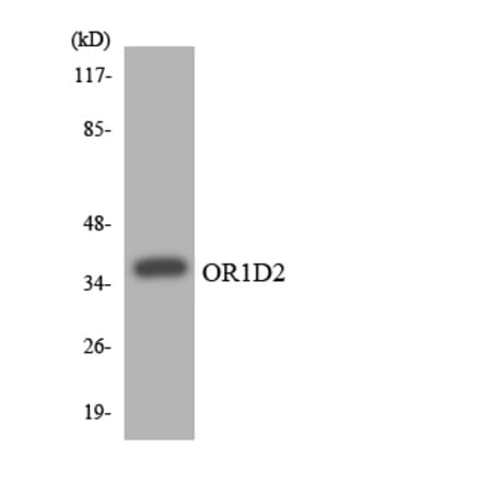 Western Blot - Anti-OR1D2 Antibody (R12-3152) - Antibodies.com