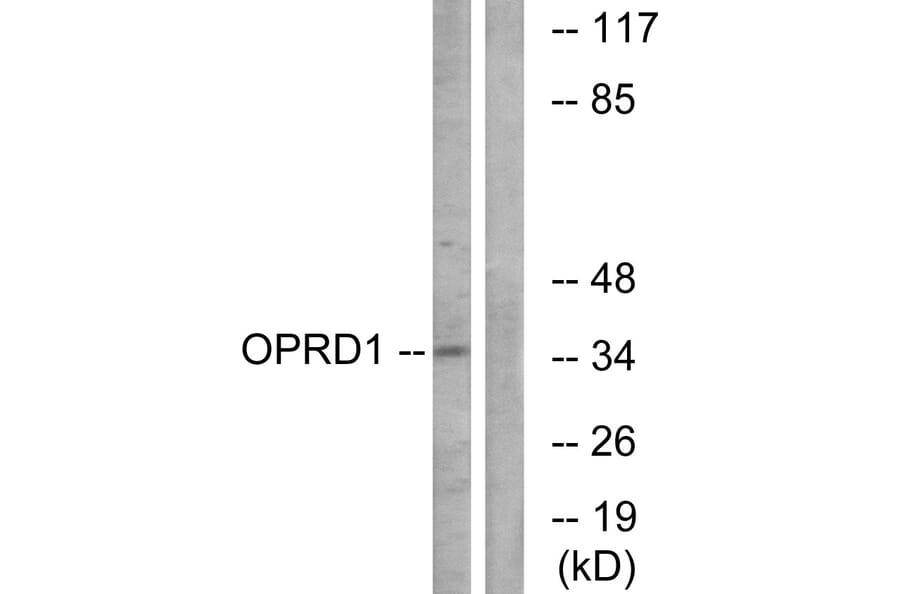 Western Blot - Anti-OPRD1 Antibody (G490) - Antibodies.com