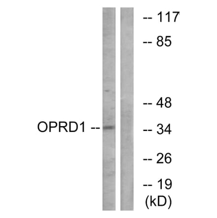 Western Blot - Anti-OPRD1 Antibody (G490) - Antibodies.com