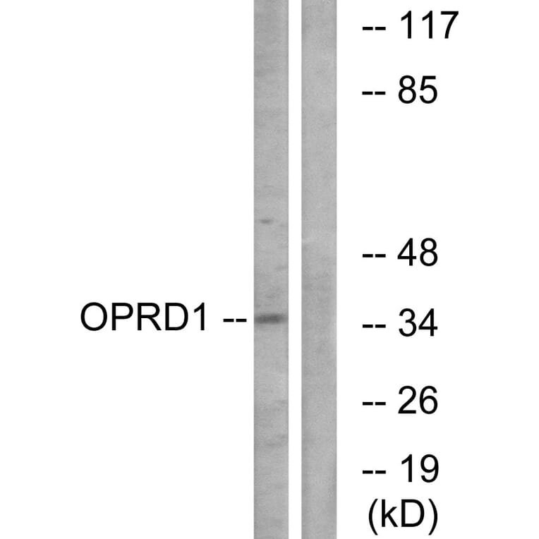 Western Blot - Anti-OPRD1 Antibody (G490) - Antibodies.com