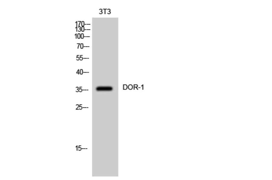 Western Blot - Anti-OPRD1 Antibody (G490) - Antibodies.com