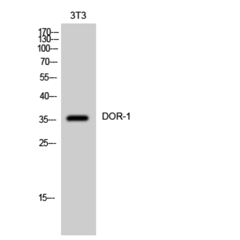 Western Blot - Anti-OPRD1 Antibody (G490) - Antibodies.com