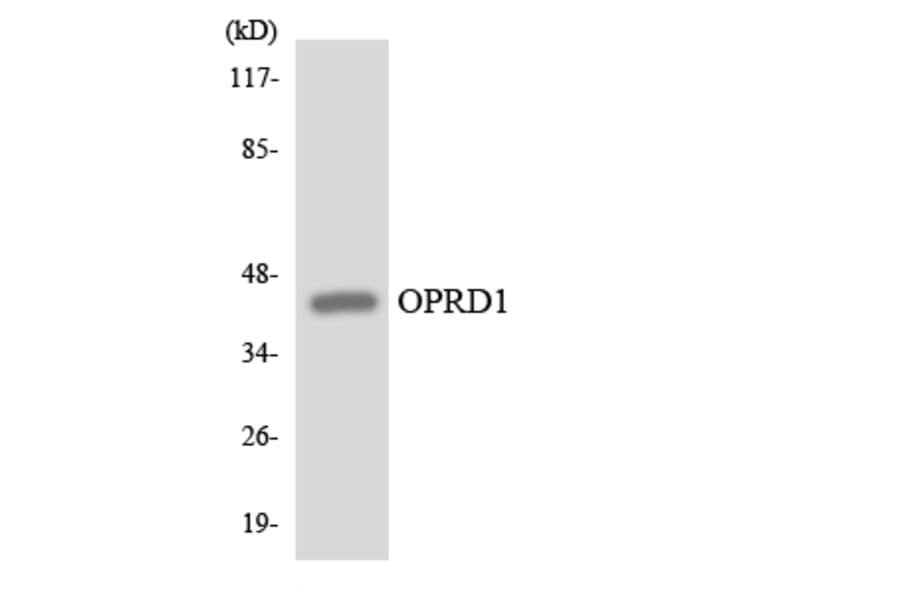Western Blot - Anti-OPRD1 Antibody (R12-3122) - Antibodies.com