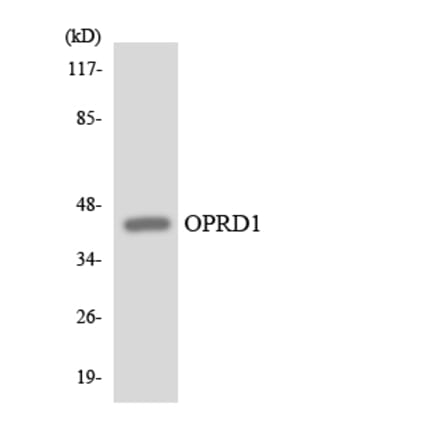 Western Blot - Anti-OPRD1 Antibody (R12-3122) - Antibodies.com