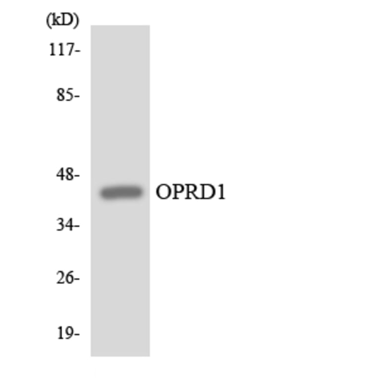Western Blot - Anti-OPRD1 Antibody (R12-3122) - Antibodies.com